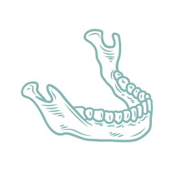 Jawbone Preparation