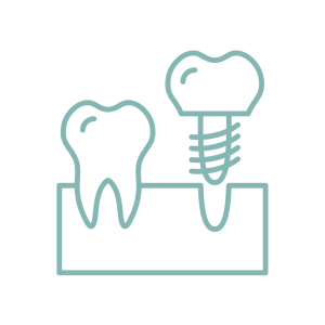 Need To Replace A Single Anterior Tooth