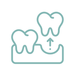 Tooth Extraction (Implant)