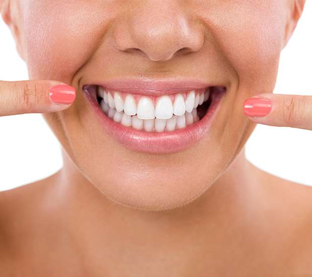 Houston What Is Gum Contouring and Reshaping