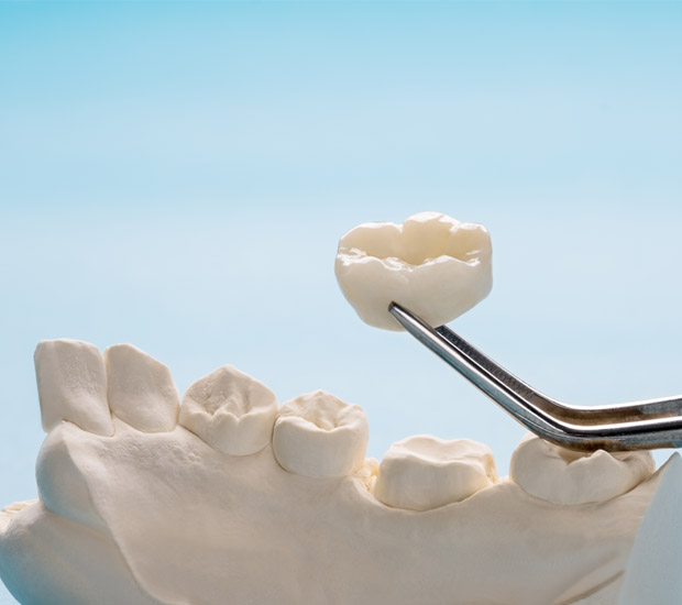 Houston Prosthodontist